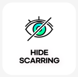 HIDE SCARRING — รอยแผลเป็นที่มองไม่เห็น